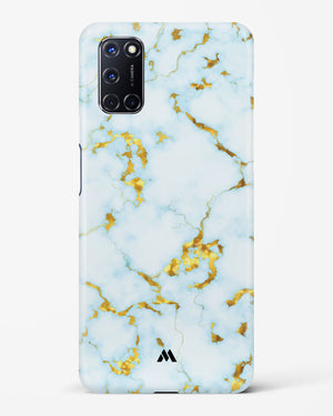 White Gold Marble Hard Case Phone Cover-(Oppo)