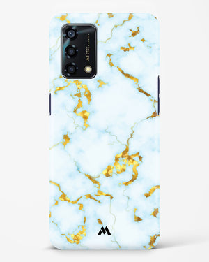 White Gold Marble Hard Case Phone Cover-(Oppo)