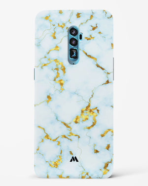 White Gold Marble Hard Case Phone Cover-(Oppo)