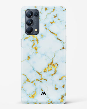 White Gold Marble Hard Case Phone Cover-(Oppo)