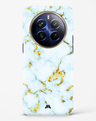 White Gold Marble Hard Case Phone Cover (Realme)
