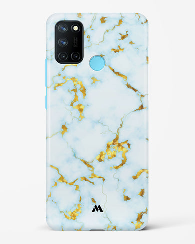 White Gold Marble Hard Case Phone Cover-(Realme)