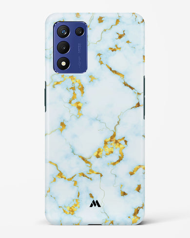 White Gold Marble Hard Case Phone Cover-(Realme)