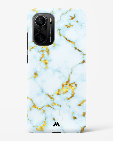 White Gold Marble Hard Case Phone Cover-(Xiaomi)