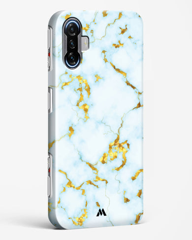 White Gold Marble Hard Case Phone Cover-(Xiaomi)