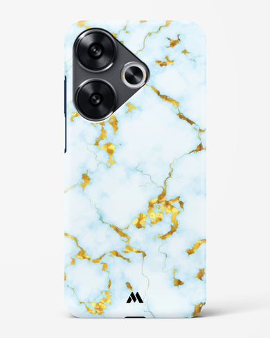 White Gold Marble Hard Case Phone Cover (Xiaomi)