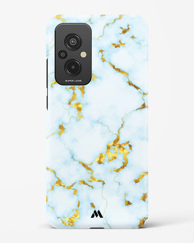 White Gold Marble Hard Case Phone Cover (Xiaomi)