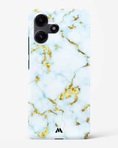 White Gold Marble Hard Case Phone Cover (Xiaomi)