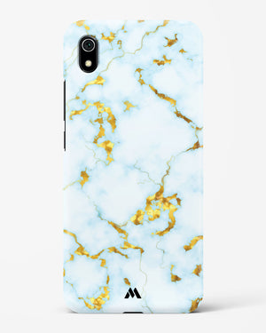 White Gold Marble Hard Case Phone Cover (Xiaomi)