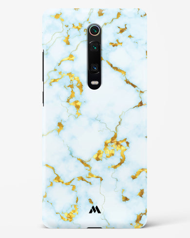 White Gold Marble Hard Case Phone Cover-(Xiaomi)