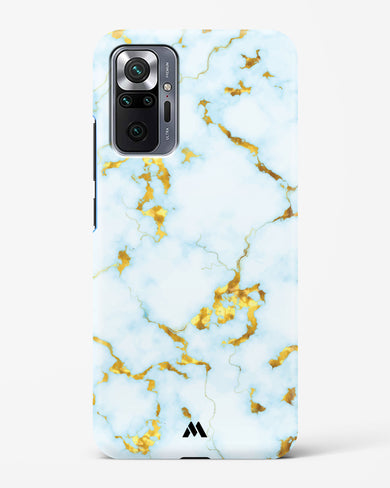 White Gold Marble Hard Case Phone Cover-(Xiaomi)