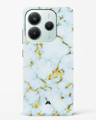 White Gold Marble Hard Case Phone Cover (Xiaomi)