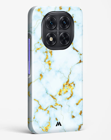 White Gold Marble Hard Case Phone Cover (Xiaomi)