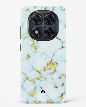 White Gold Marble Hard Case Phone Cover (Xiaomi)