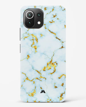 White Gold Marble Hard Case Phone Cover-(Xiaomi)