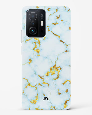 White Gold Marble Hard Case Phone Cover-(Xiaomi)