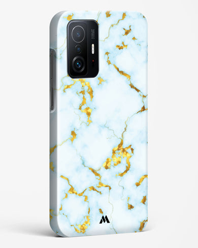 White Gold Marble Hard Case Phone Cover (Xiaomi)