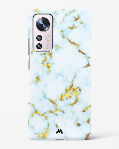 White Gold Marble Hard Case Phone Cover-(Xiaomi)