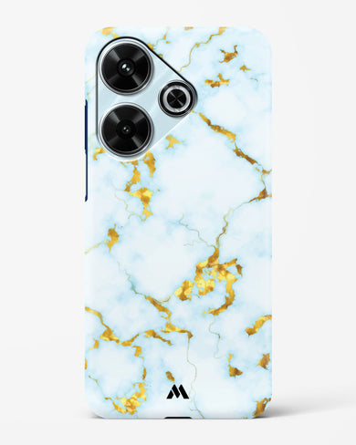 White Gold Marble Hard Case Phone Cover (Xiaomi)