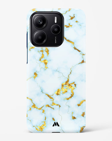 White Gold Marble Hard Case Phone Cover (Xiaomi)