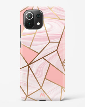 Liquid Marble in Pink Hard Case Phone Cover (Xiaomi)