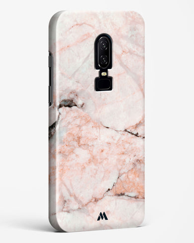 White Rose Marble Hard Case Phone Cover (OnePlus)