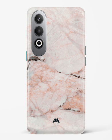 White Rose Marble Hard Case Phone Cover (OnePlus)