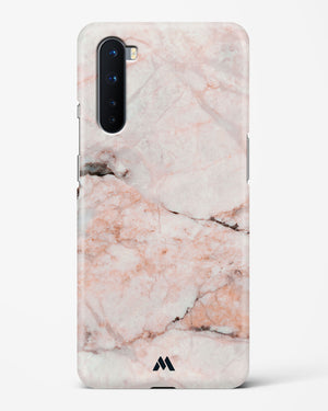 White Rose Marble Hard Case Phone Cover (OnePlus)