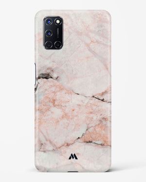 White Rose Marble Hard Case Phone Cover-(Oppo)