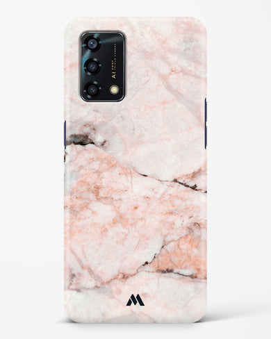 White Rose Marble Hard Case Phone Cover (Oppo)