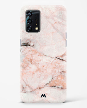 White Rose Marble Hard Case Phone Cover-(Oppo)