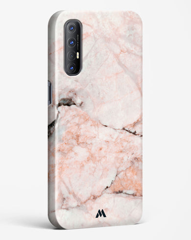 White Rose Marble Hard Case Phone Cover (Oppo)