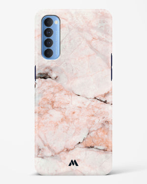 White Rose Marble Hard Case Phone Cover (Oppo)