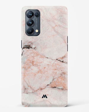 White Rose Marble Hard Case Phone Cover-(Oppo)