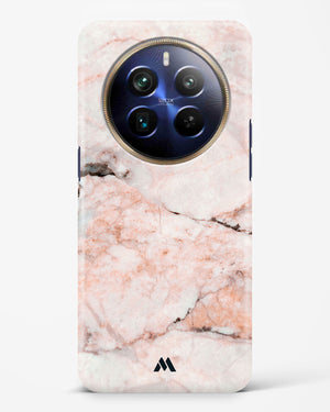 White Rose Marble Hard Case Phone Cover (Realme)