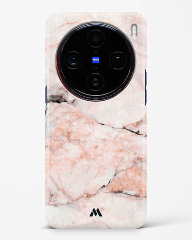 White Rose Marble Hard Case Phone Cover (Vivo)