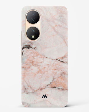 White Rose Marble Hard Case Phone Cover (Vivo)