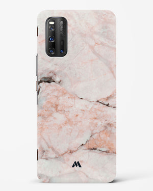 White Rose Marble Hard Case Phone Cover-(Vivo)