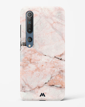 White Rose Marble Hard Case Phone Cover-(Xiaomi)