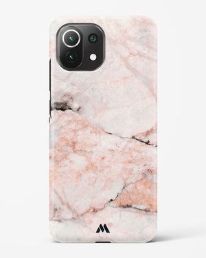 White Rose Marble Hard Case Phone Cover (Xiaomi)