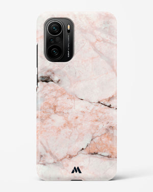 White Rose Marble Hard Case Phone Cover (Xiaomi)