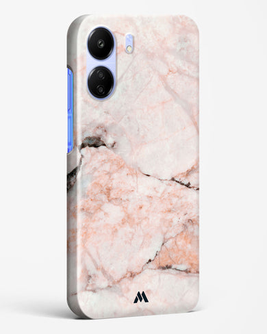 White Rose Marble Hard Case Phone Cover (Xiaomi)