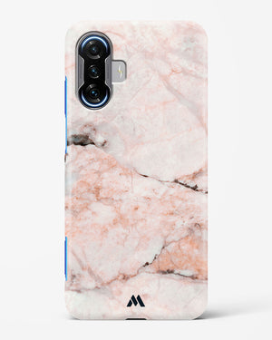 White Rose Marble Hard Case Phone Cover (Xiaomi)