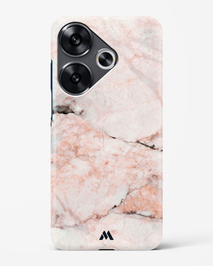 White Rose Marble Hard Case Phone Cover (Xiaomi)