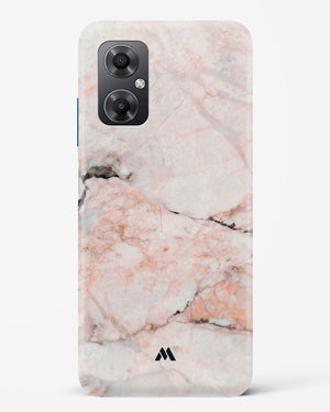 White Rose Marble Hard Case Phone Cover (Xiaomi)