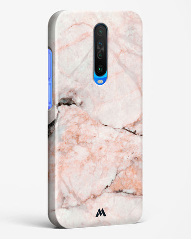 White Rose Marble Hard Case Phone Cover (Xiaomi)