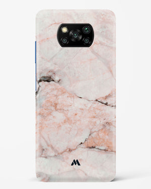 White Rose Marble Hard Case Phone Cover-(Xiaomi)