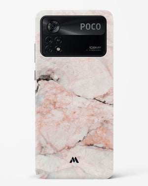 White Rose Marble Hard Case Phone Cover (Xiaomi)