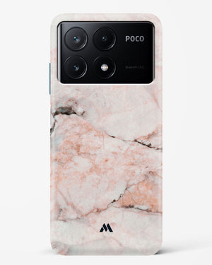 White Rose Marble Hard Case Phone Cover (Xiaomi)
