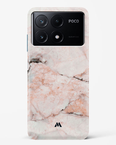 White Rose Marble Hard Case Phone Cover (Xiaomi)